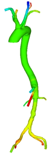 ARTERIAL_TREE_AORTA