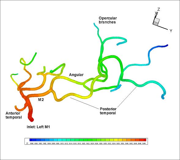 Cranial Arteries